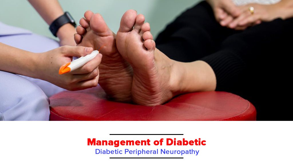 Management of Diabetic Peripheral Neuropathy | BioFlex Pakistan