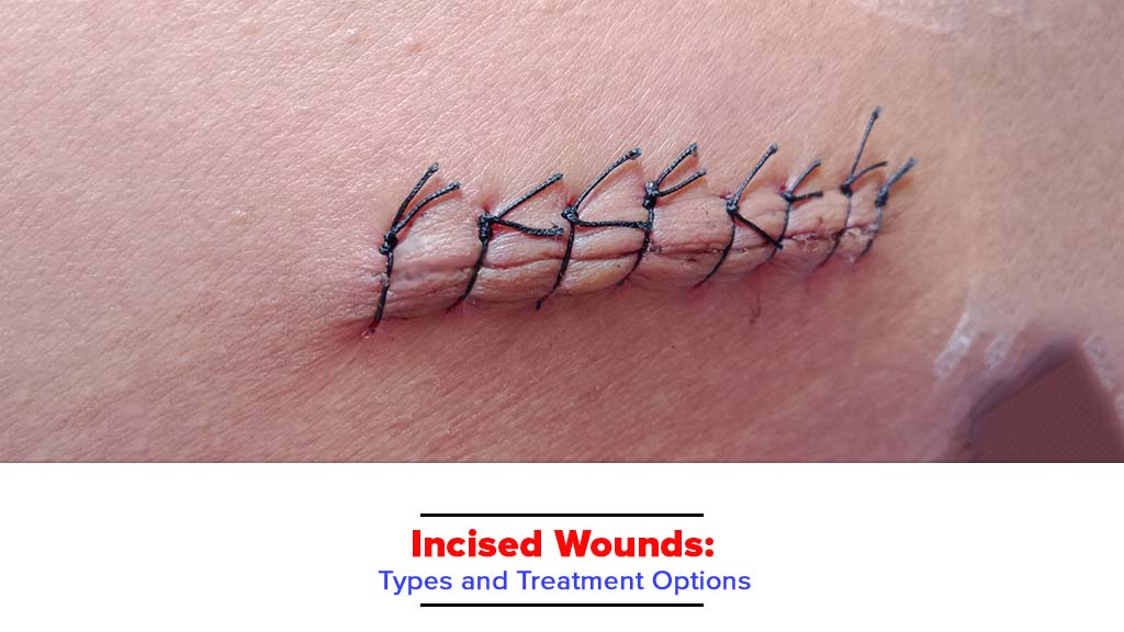 incised wound