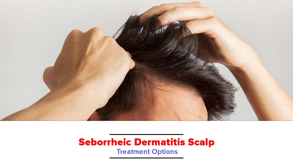 Seborrheic Dermatitis Scalp Treatment Options Bioflex Pakistan