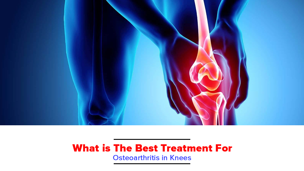 What Is The Best Treatment For Osteoarthritis In Knees Bioflex Pakistan